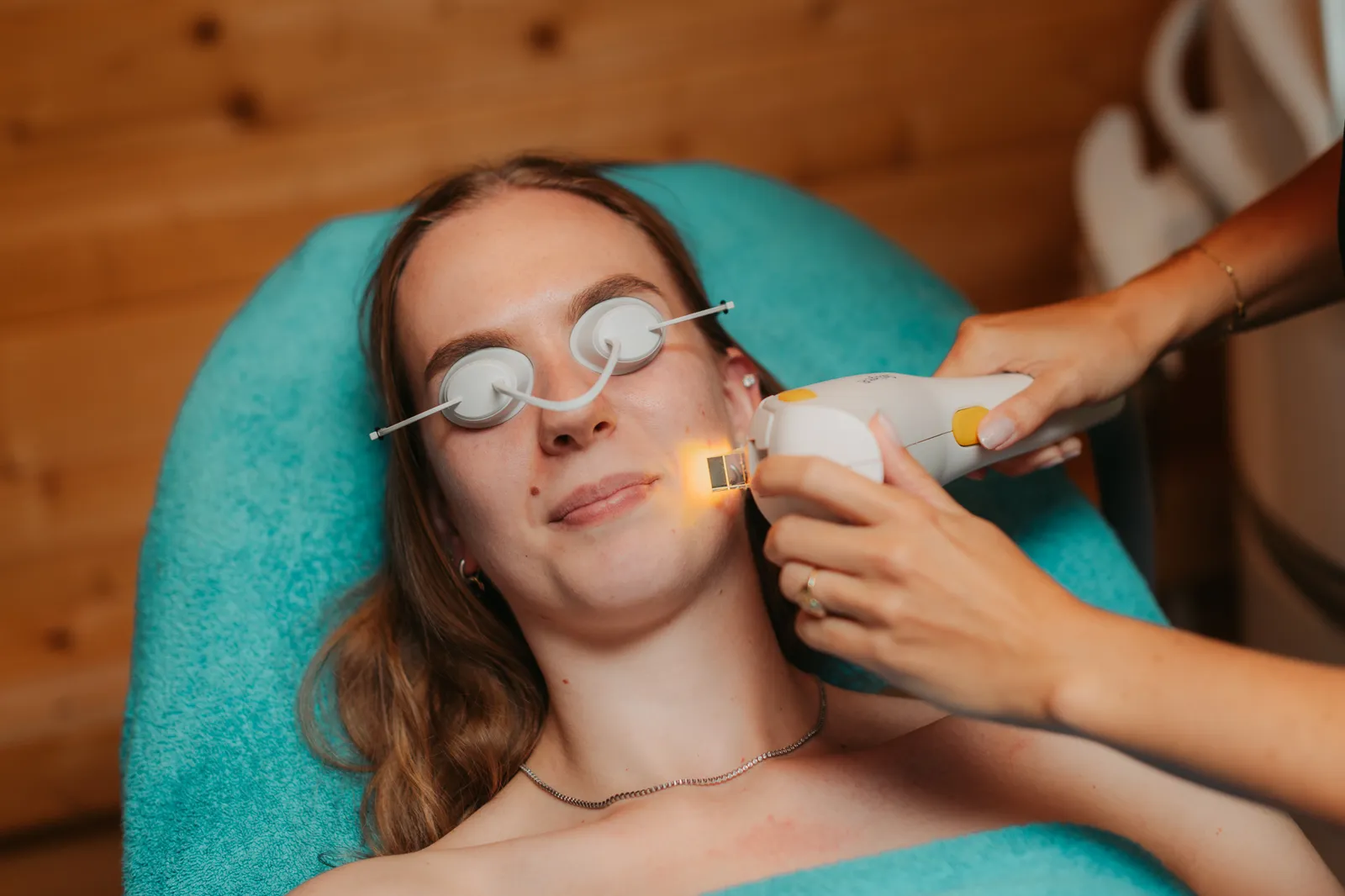 Close-up van een IPL-behandeling op het gezicht met beschermbril